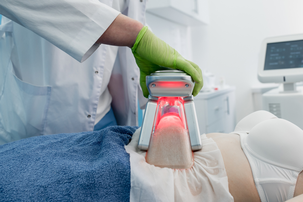 Mulher recebendo tratamento estético - Criolipolise